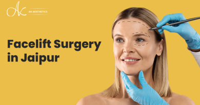 A Comprehensive Guide to Facelift Surgery