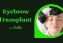 What You Need to Know About Eyebrow Transplants